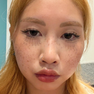 Customer result